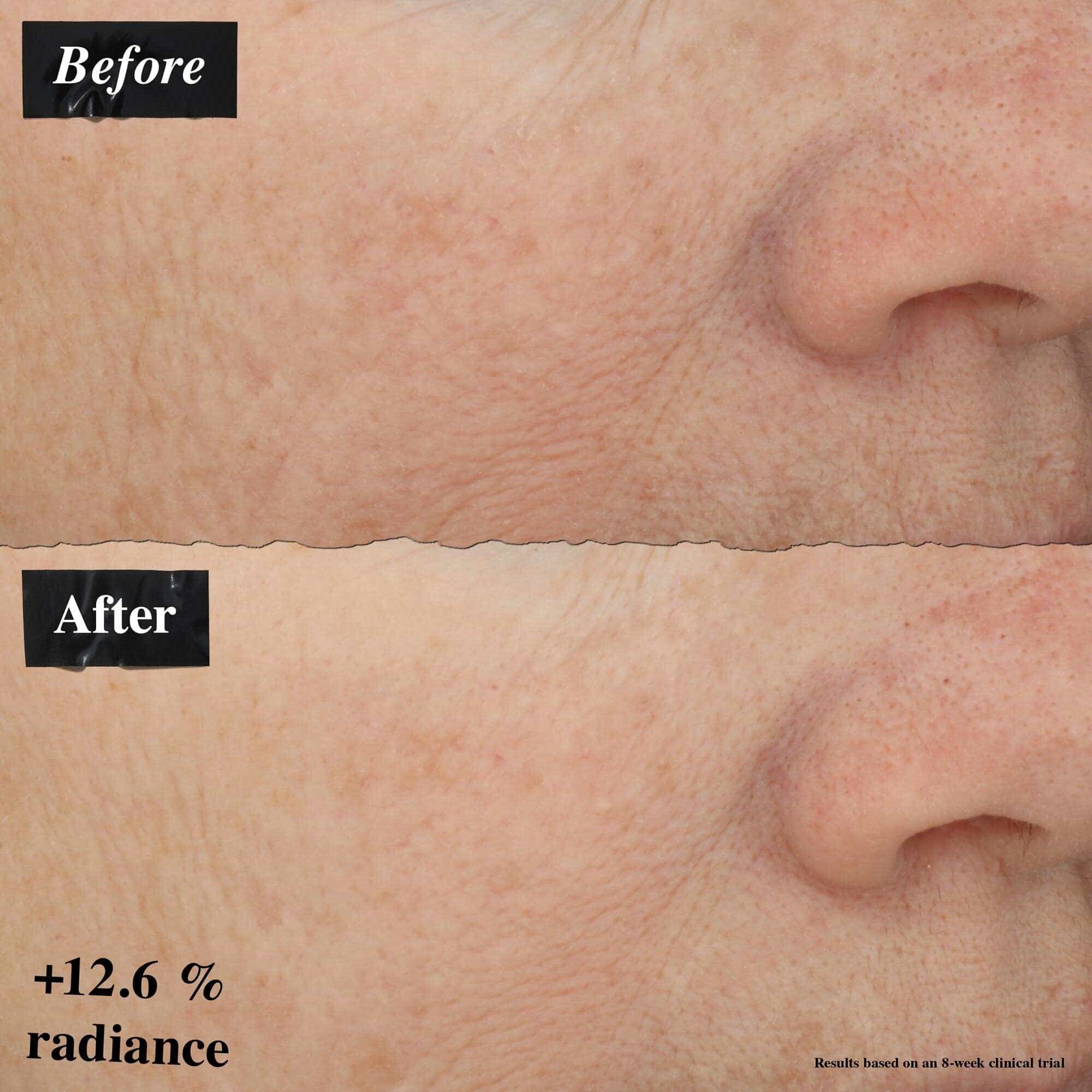A before-and-after image comparison showing improvement in skin redness after using Powerful-Strength Line-Reducing Concentrate.