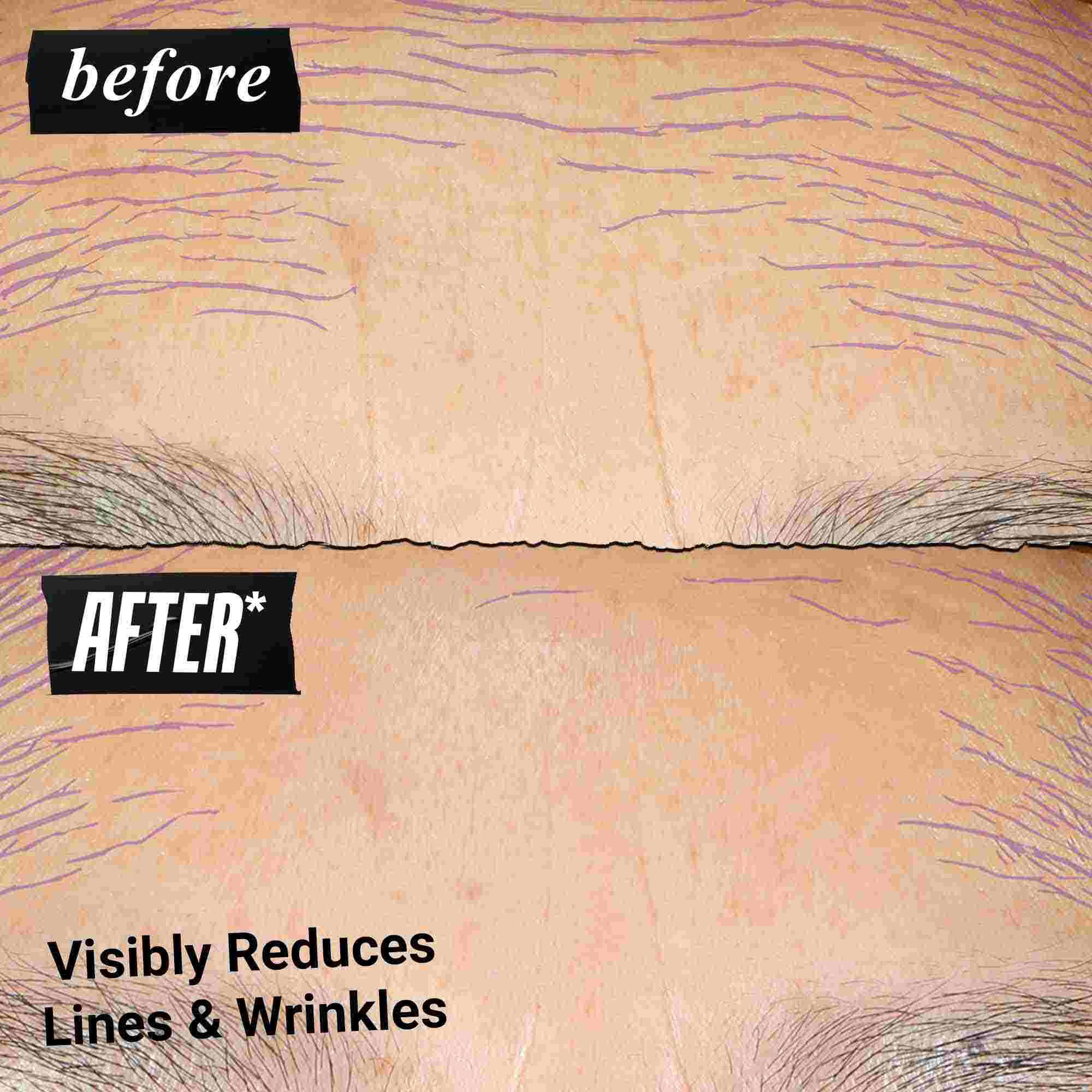 Before & After photo - Kiehl's Retinol Skin Renewing Daily Microdose helps improve tone & texture