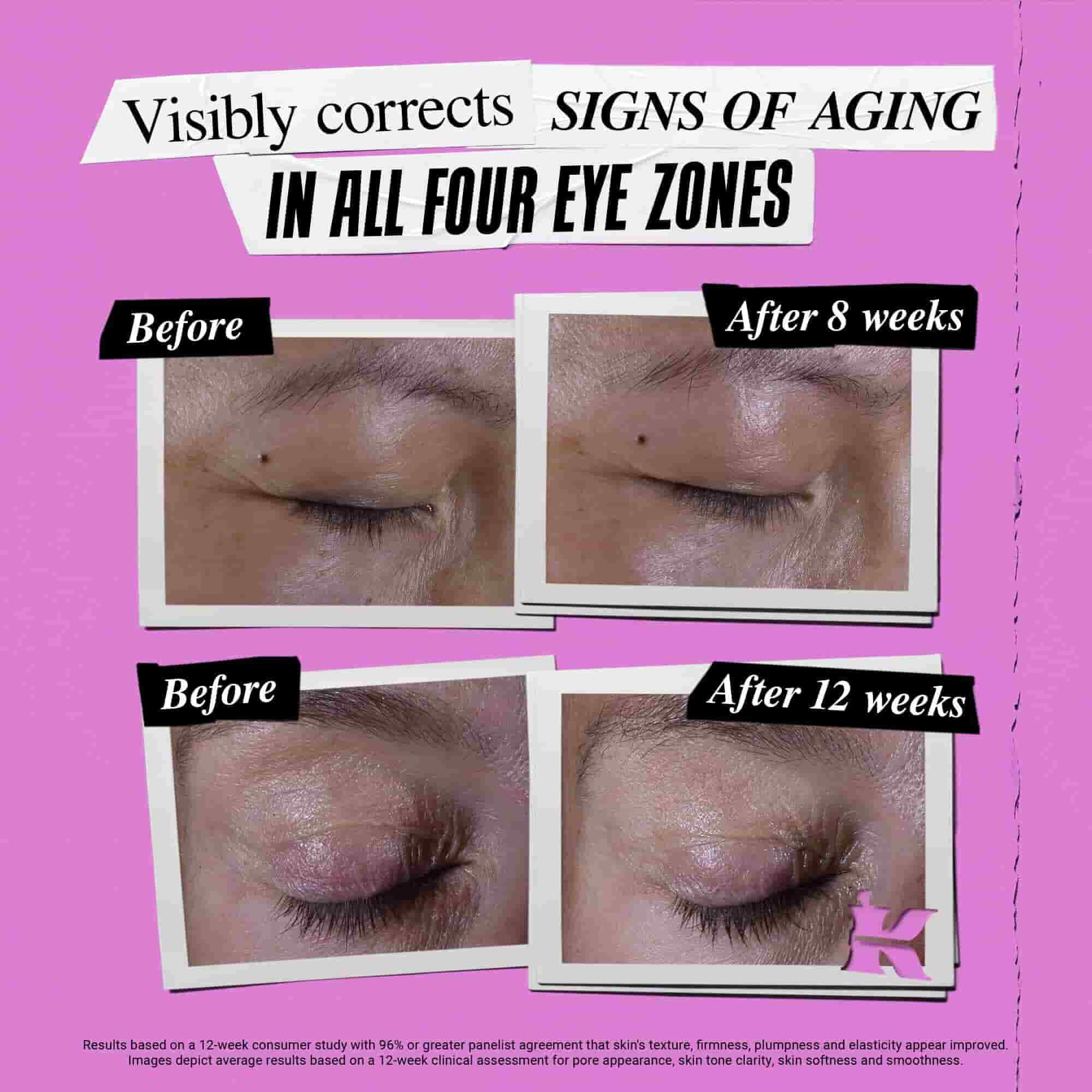Before & After photo for Kiehl's Super Multi-Corrective Eye Zone Treatment correcting signs of aging