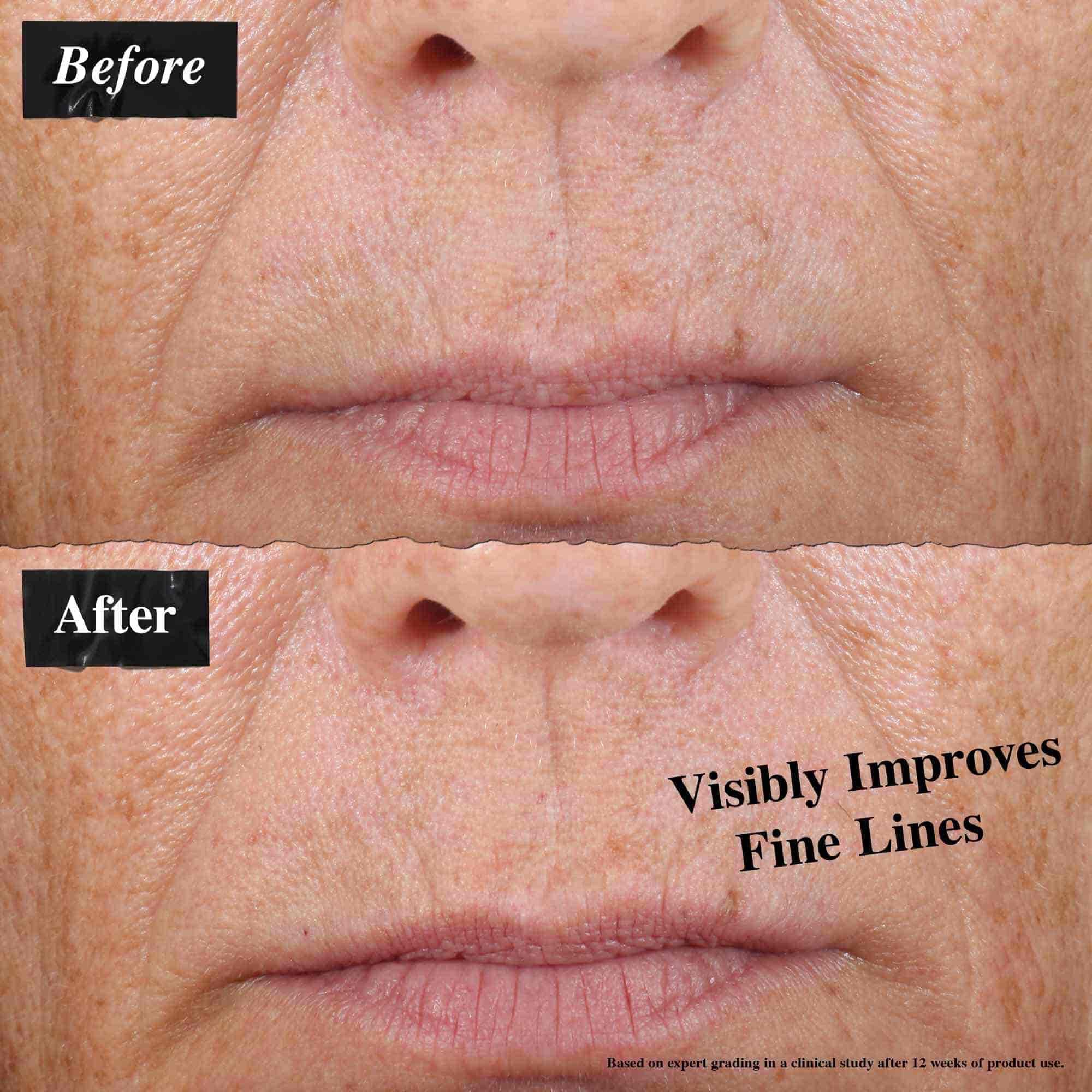 A before-and-after comparison showing visibly reduced fine lines after using Midnight Recovery Concentrate face oil.
