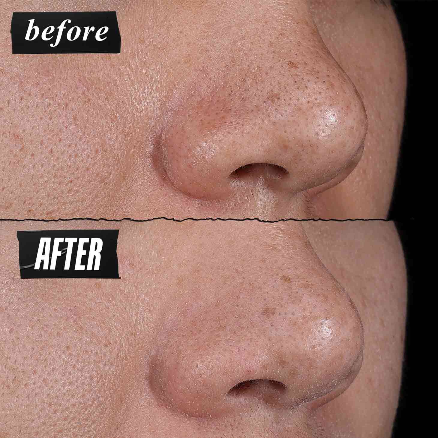 Before & After photo - Kiehl's Rare Earth Deep Pore Cleansing Masque visibly reduces pores