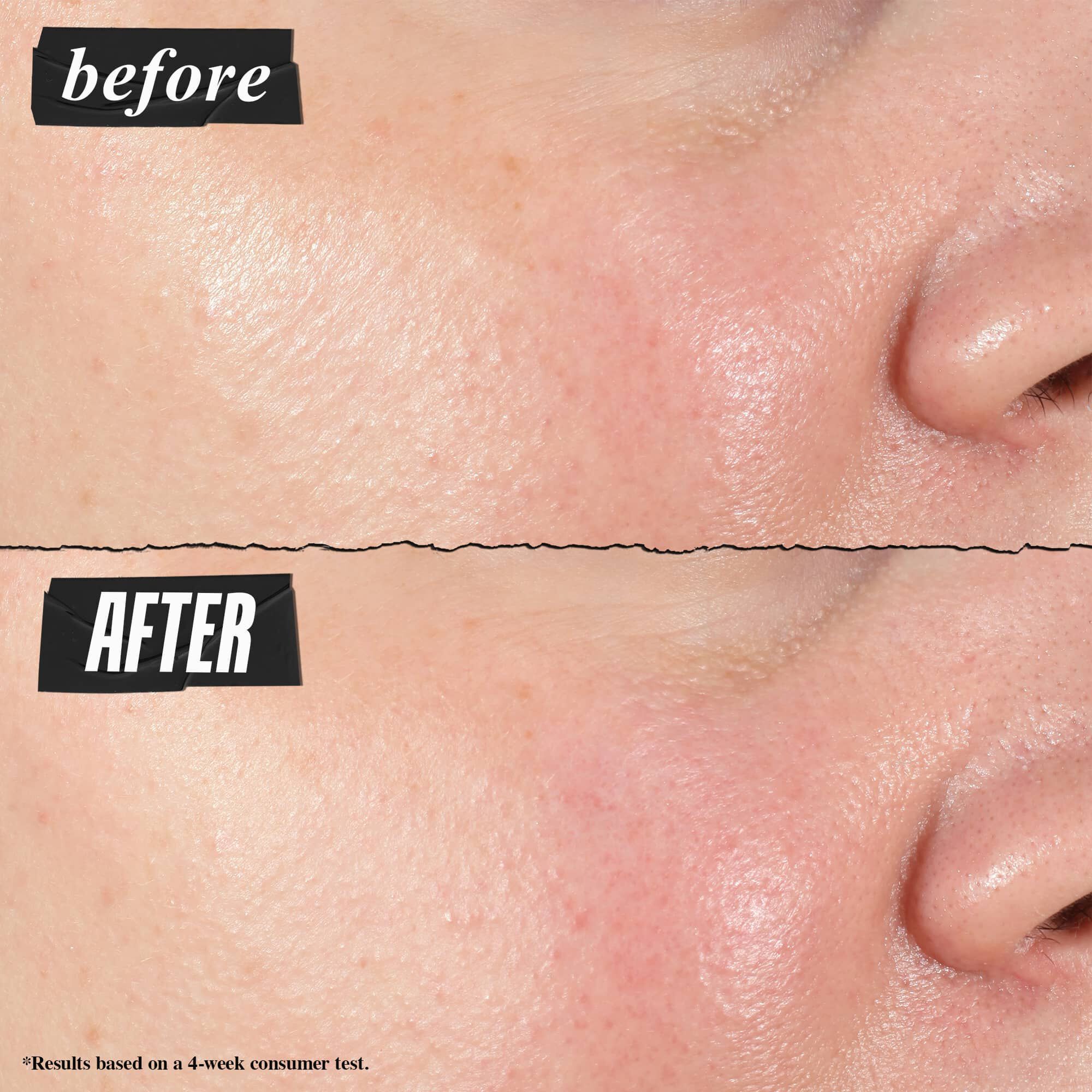 Oncesi & Sonrası fotoğraf - Kiehl's Hydro Plumping Serum Concentrate gozeneklerin gorunumunu belirgin şekilde azaltır