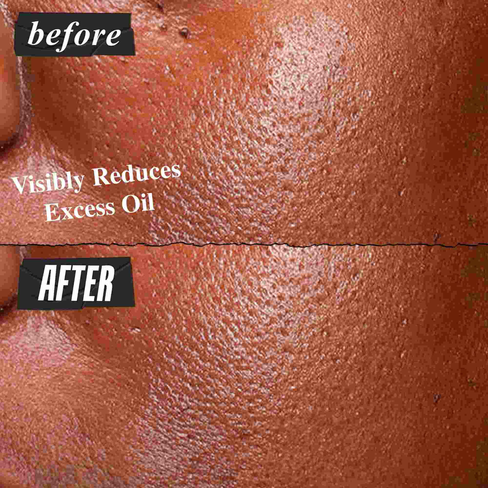 Kiehl's Ultra Pure High-Potency Serum'un fazla yağı gozle gorulur şekilde azaltmasını gosteren once ve sonra fotoğrafı.