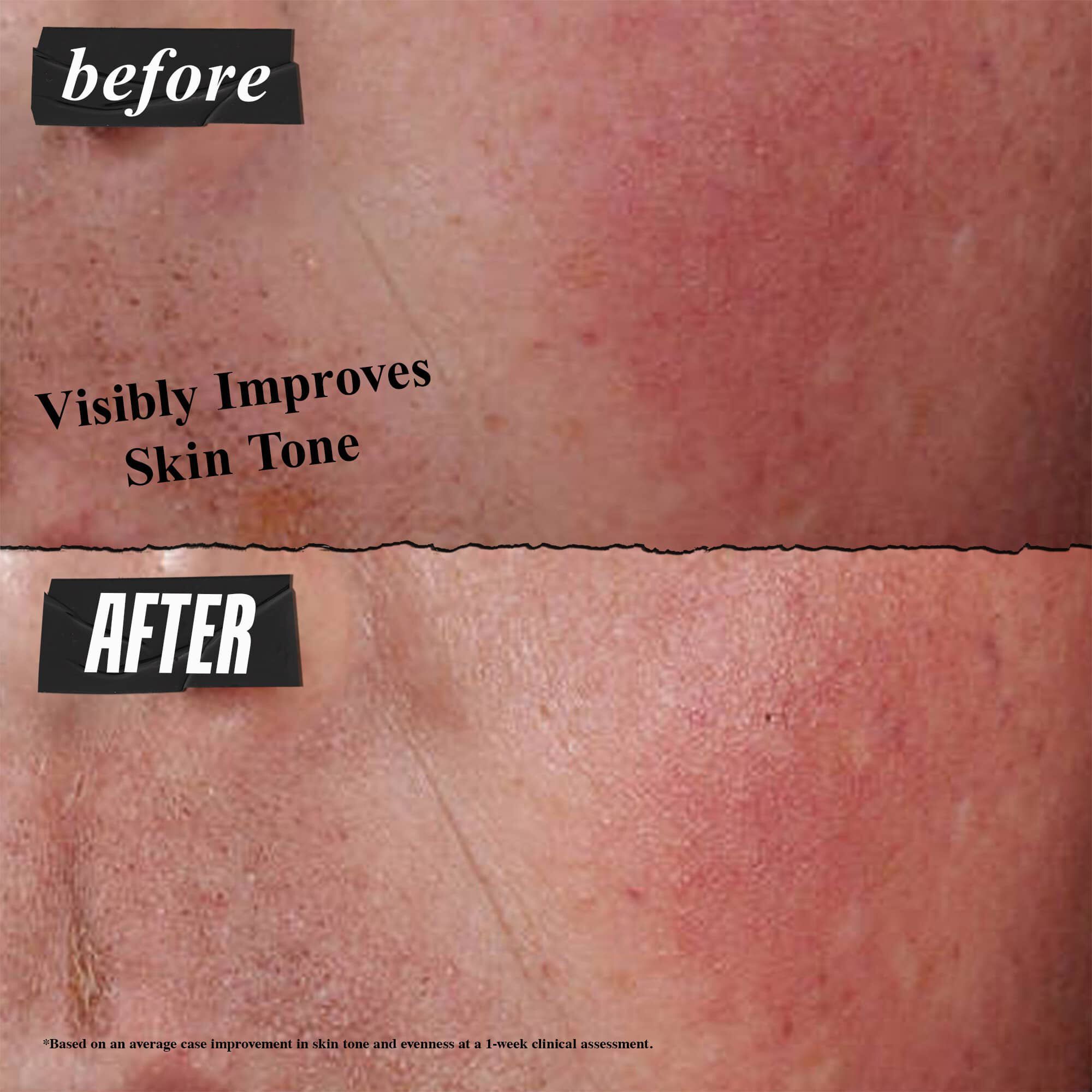 Oncesi ve Sonrası fotoğraf - Kiehl's Ultra Facial Barrier Cream, cilt tonunu gozle gorulur şekilde iyileştirir.