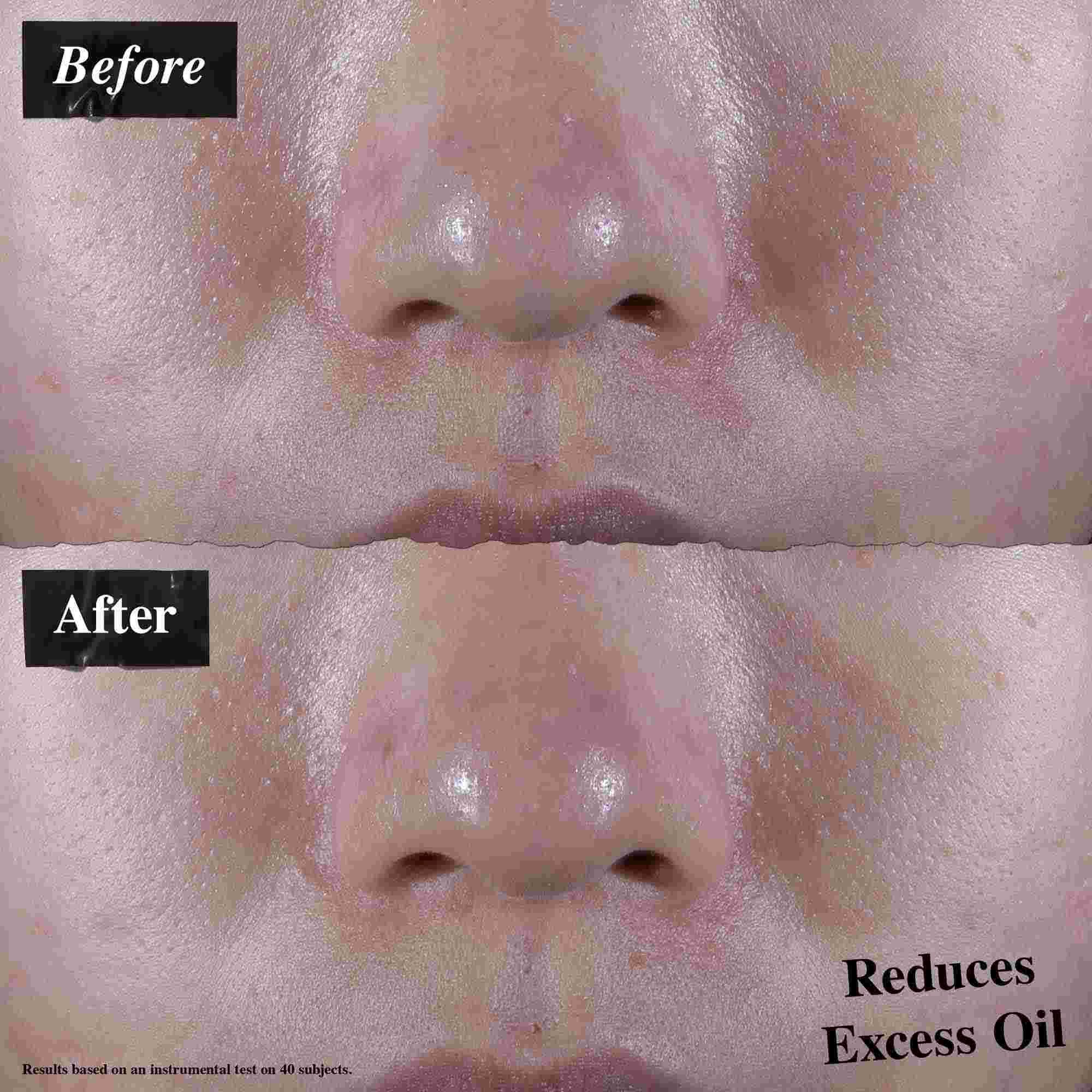 Before-and-after comparison showing reduced excess oil after using Ultra Facial Oil-Free Gel Cream.