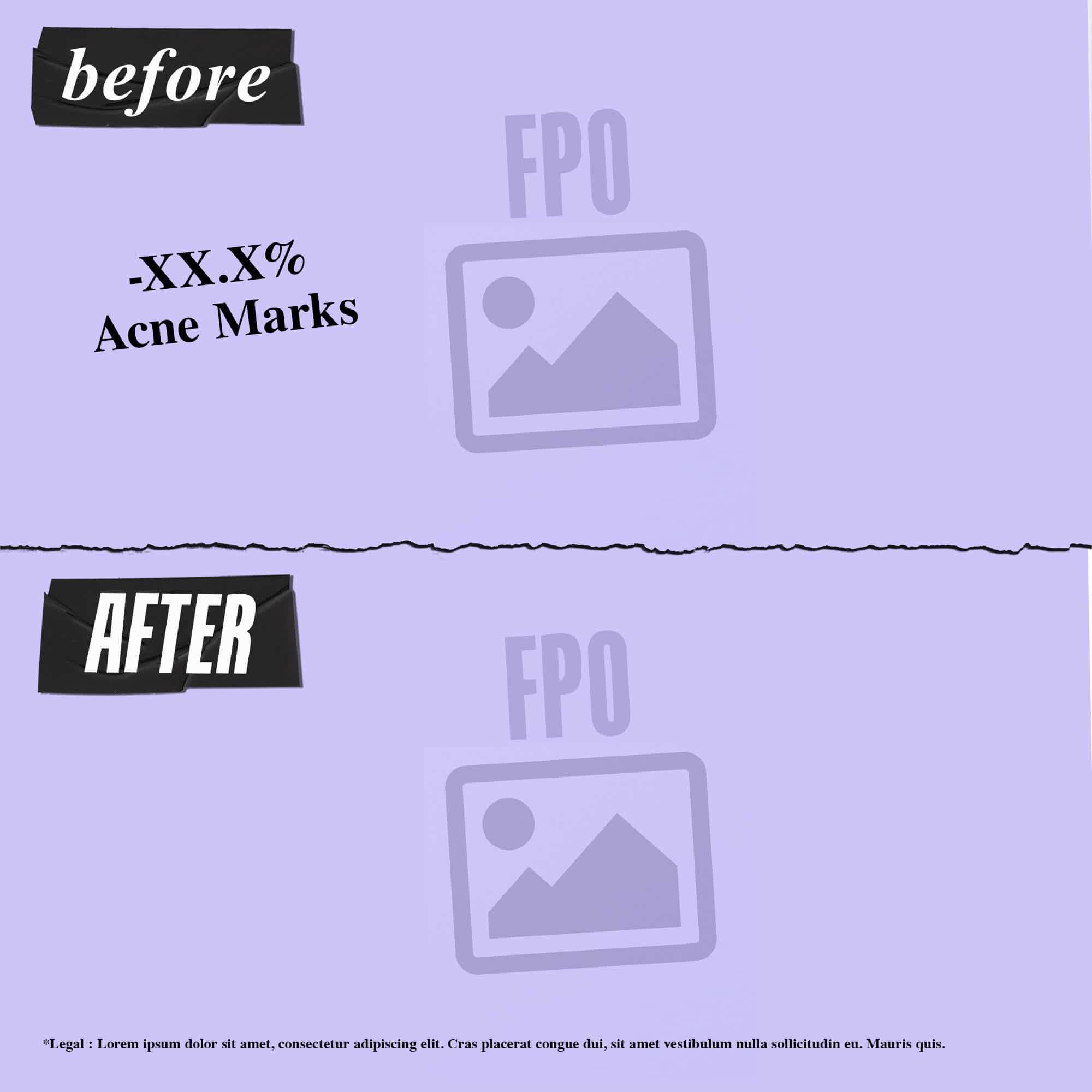 Clearly Corrective™ Clarity-Activating Soothing Emulsion - Hafif Dokulu Losyon