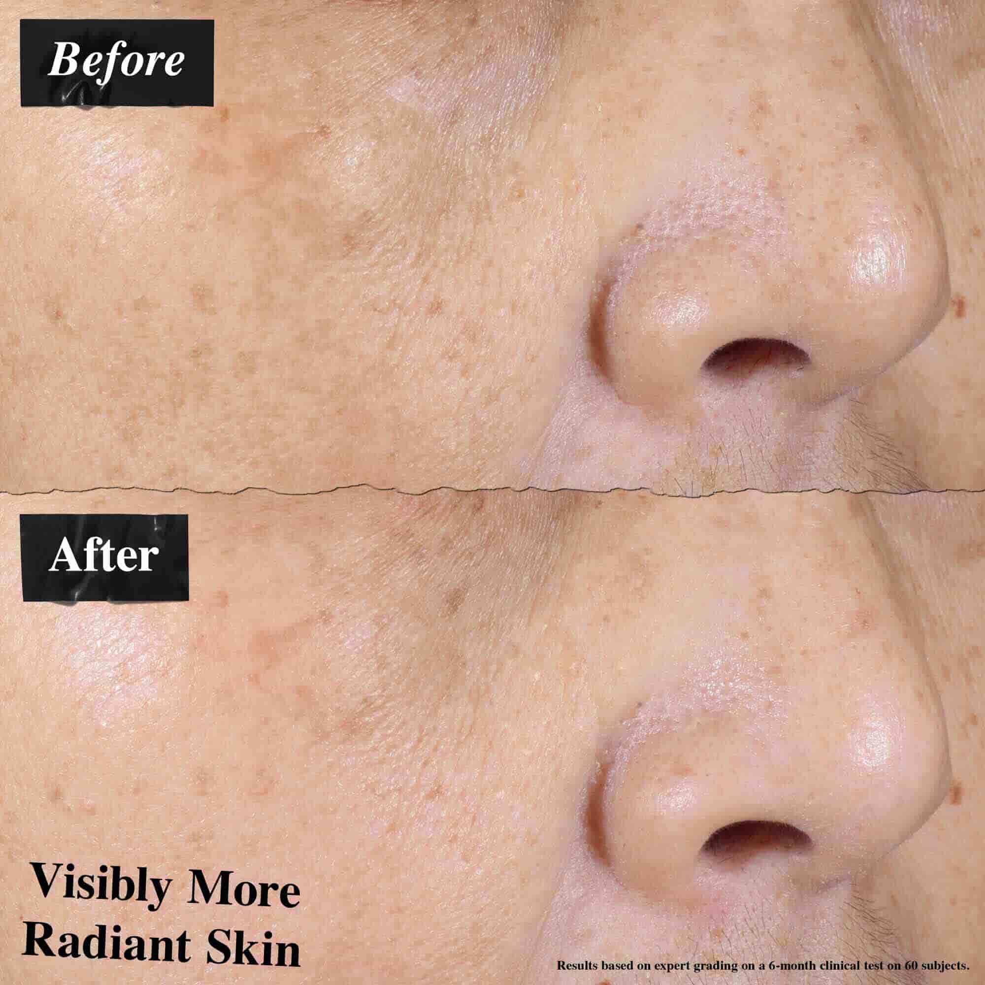 Before-and-after comparison showing visibly reduced skin redness after using Ultra-Light Daily UV Defense.
