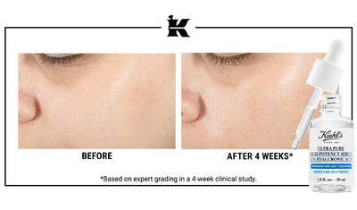 Retinol Serum Oncesi ve Sonrası