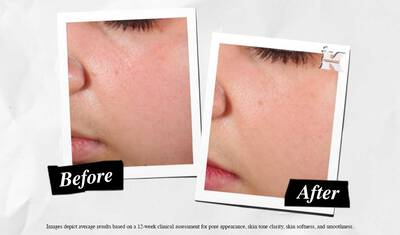 Oncesi ve Sonrası Super Multi-Corrective Soft Cream