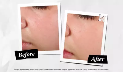 Oncesi ve Sonrası Super Multi-Corrective Soft Cream
